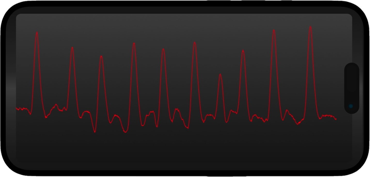 CORAI — smartphone displaying a photoplethysmography heart rhythm trace